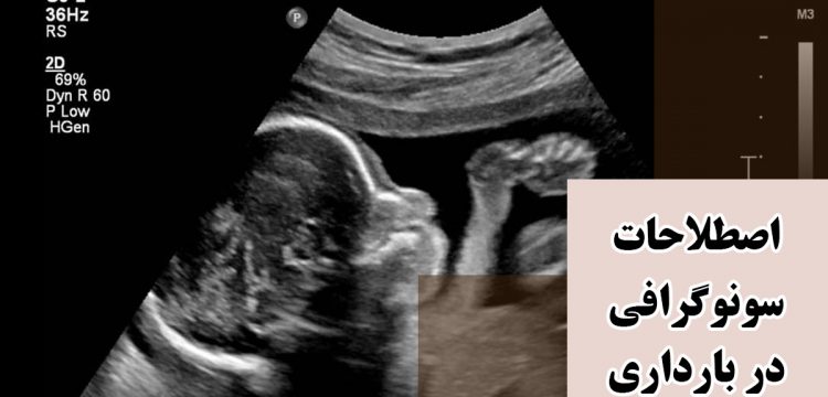 اصطلاحات سونوگرافي در بارداري